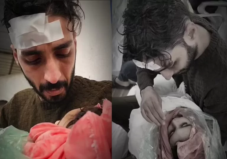 وداع شاب فلسطيني مصاب لابن شقيقه الشهيد بغزة