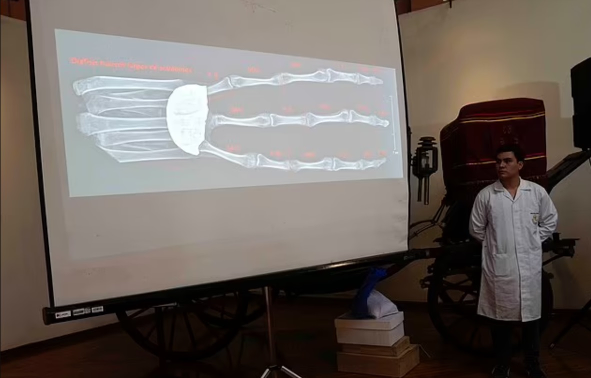 خضعت اليد ذات الأصابع الثلاثة لفحوصات الأشعة السينية