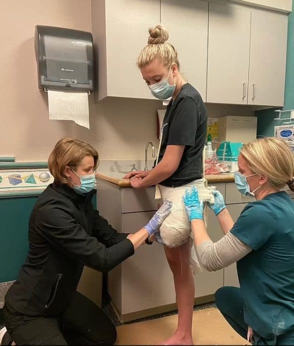 احتاجت المراهقة إلى 21 عملية جراحية