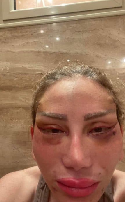 ريهام سعيد بعد عملية التجميل 