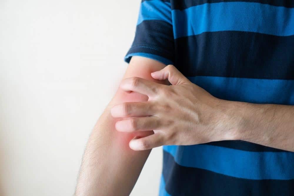 علامة خفية على الجلد تدل على أنك تعاني من النوع الثاني من السكري علامة خفية على الجلد تدل على أنك تعاني من النوع الثاني من السكري