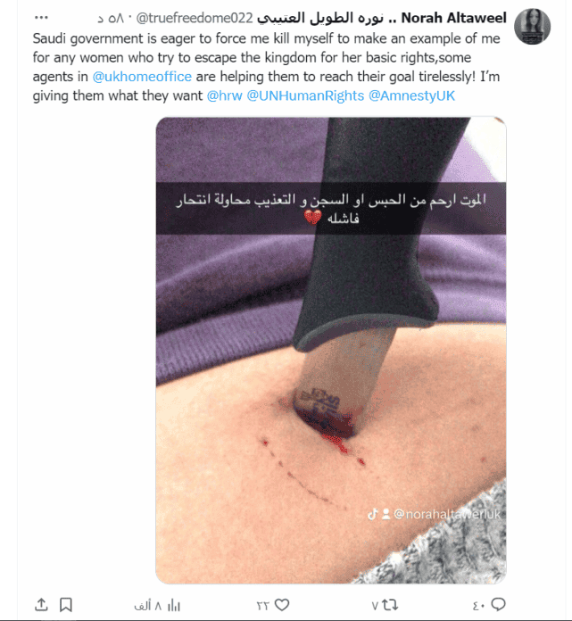 انتحار نورة الطويل