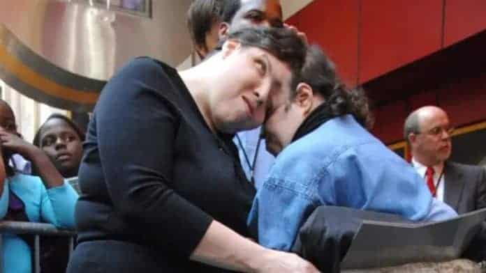 وفاة أكبر توأم ملتصق في العالم