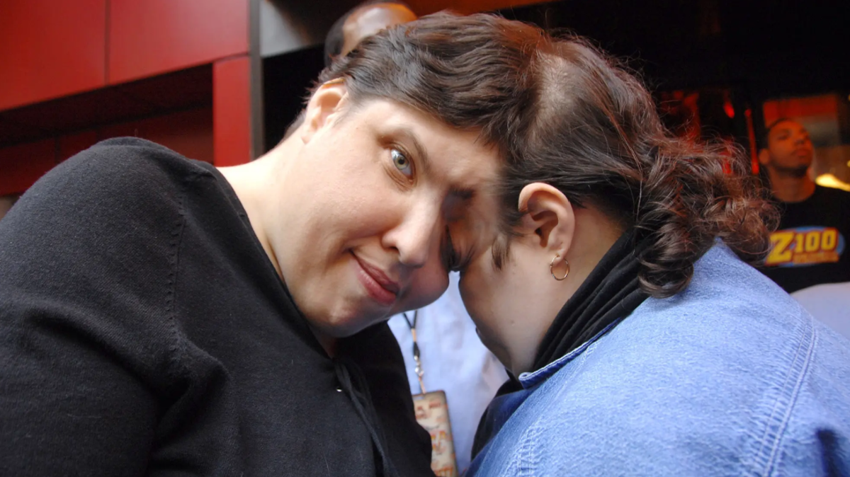 متحول جنسياً.. وفاة أكبر توأم ملتصق في العالم عن عمر 62 عاماً “فيديو” وفاة أكبر توأم ملتصق في العالم