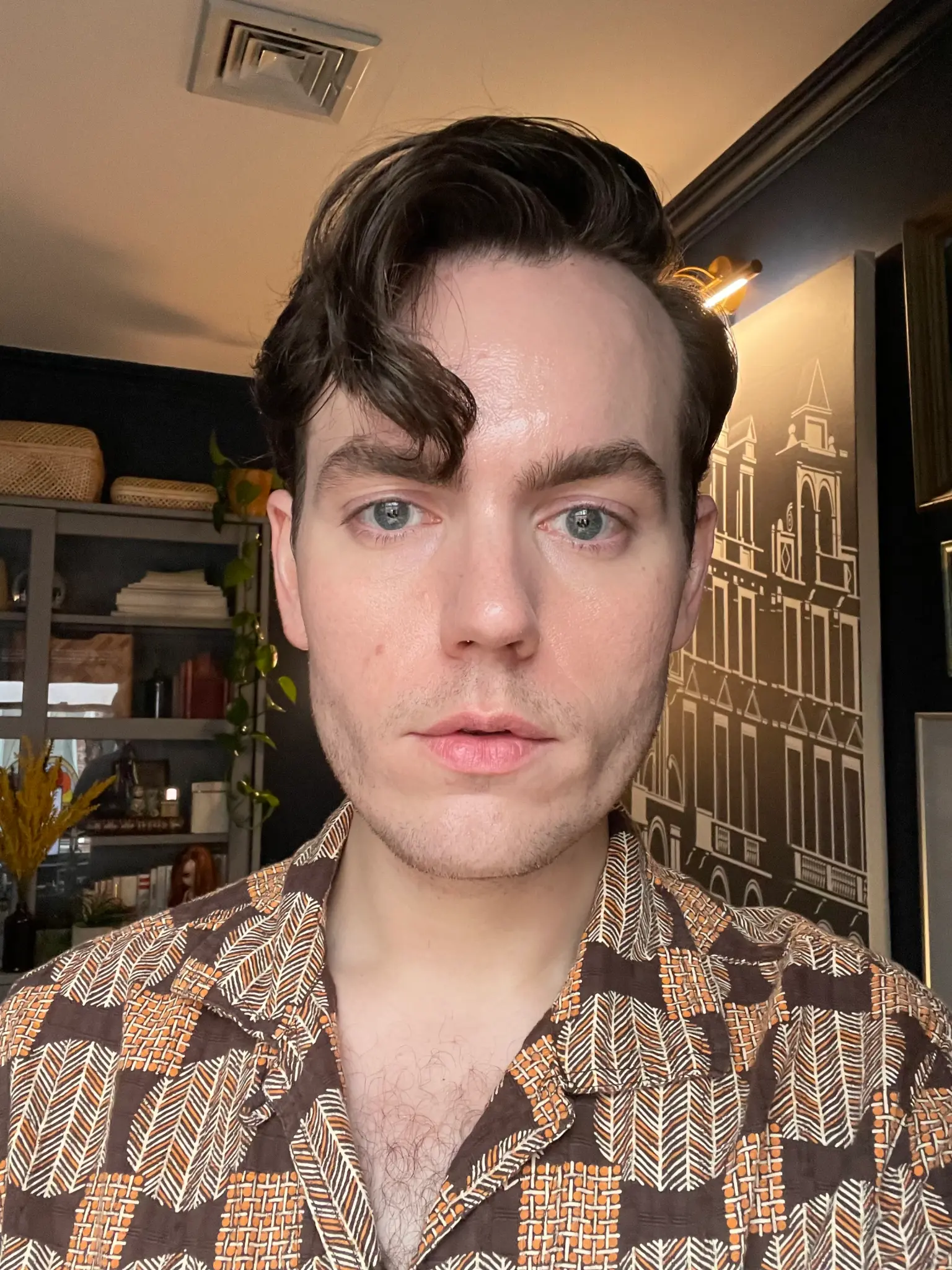 يقول ألين لصحيفة ذا بوست إنه بدأ يلاحظ تساقط شعره في العشرينيات من عمره.